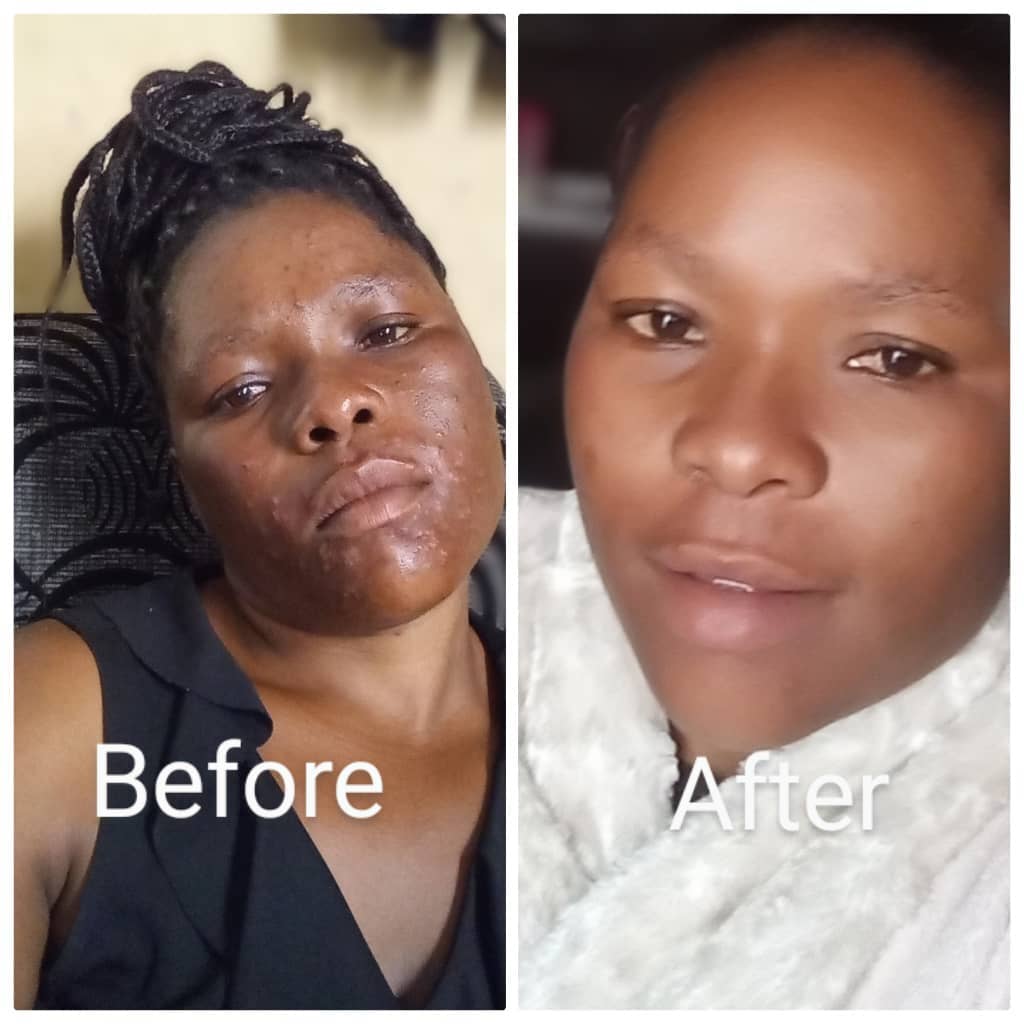 Skin Rash Transformation